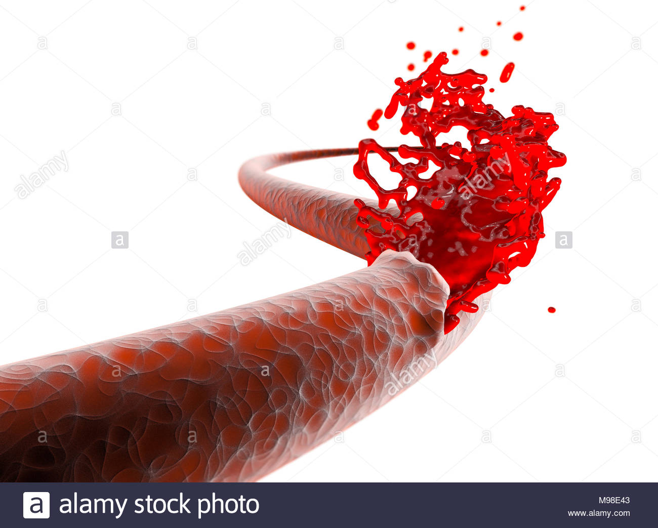internal bleeding